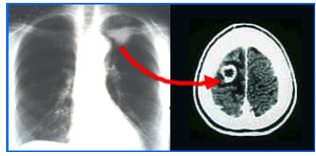 Biomedical Science & Research Biomedical Science & Research