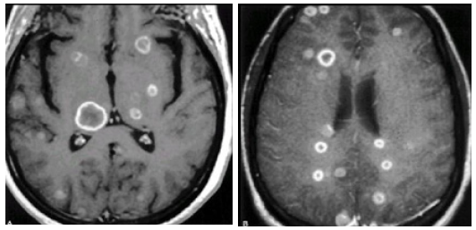 Biomedical Science & Research Biomedical Science & Research